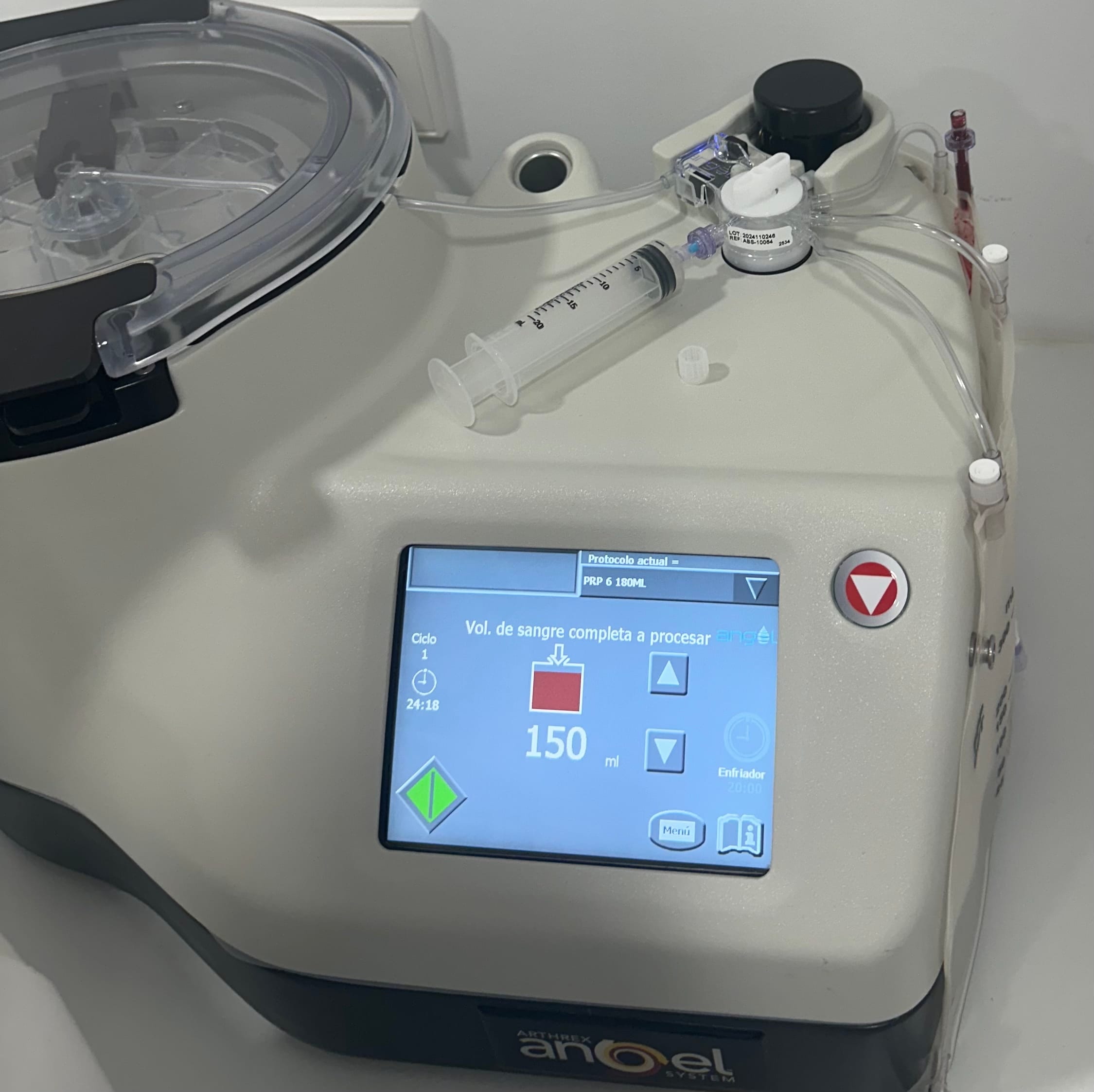 TECNOLOGIA DE VANGUARDIA : ANGEL SYSTEM ® - Regenera Medical Center